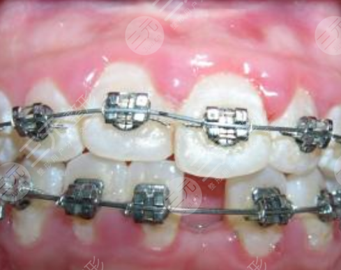 牙科机构的牙齿矫正项目