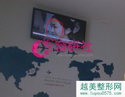 韩国芙莱思整形外科屏幕循环播放的案例