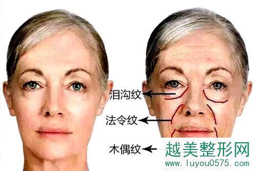 面部年轻化做得早，50岁也能活出20岁的样子