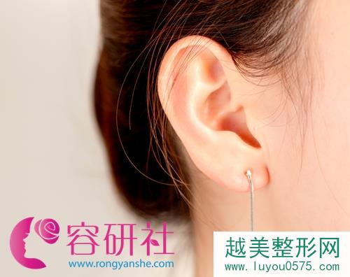 韩国PROFILE医院郑在皓耳整形中心，让你的耳朵不再“与众不同”