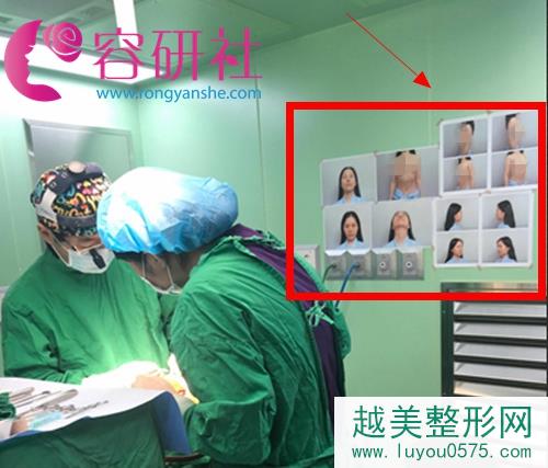 普罗菲耳profile新氧达人陈米拉鼻修复手术