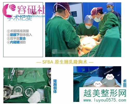 北京联合丽格的杨大平教授隆胸手术过程