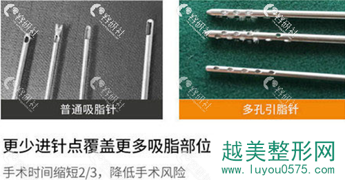 北京薇琳医疗美容医院桑建波医生使用的多孔吸脂针