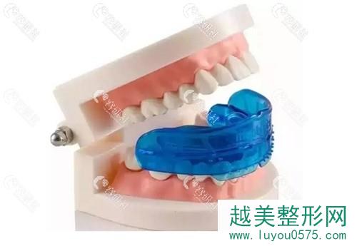 MRC儿童牙齿矫治器