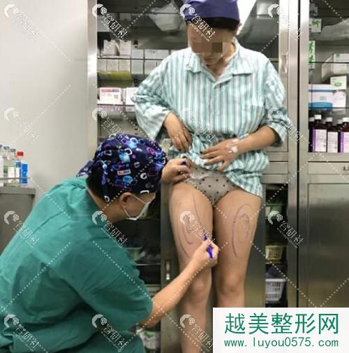 上海华美医疗美容医院何斌手术设计中