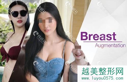 泰国KAMOL咖蒙整形医院假体隆胸案例