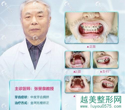 广州中家医家庭医生口腔医院牙齿矫正张景全医生