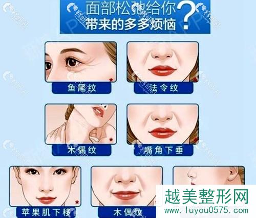 上海小切口拉皮手术可以改善的面部问题