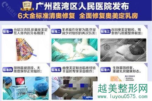 广州荔湾区人民医院奥美定取出手术优势