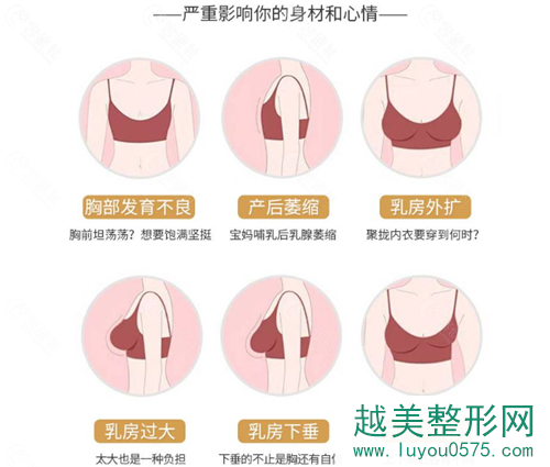胸部不同的问题很影响身材和心情，广州假体丰胸做的好的医院有哪些？