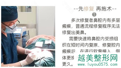 上海光博士鼻修复方法