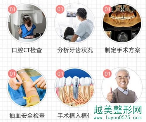 上海中博口腔种植牙手术流程介绍