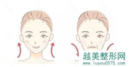 面部轮廓手术后应该如何预防下垂