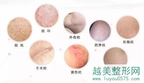 上海虹桥医院能治疗各种个疤痕
