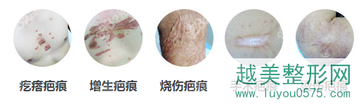 重庆骑士医院疤痕修复所开展的部分项目