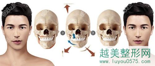 面部轮廓手术方法图