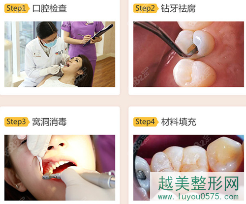 曲靖耐齿口腔看牙流程