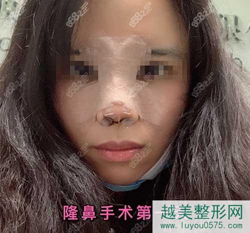 广州鼻部手术