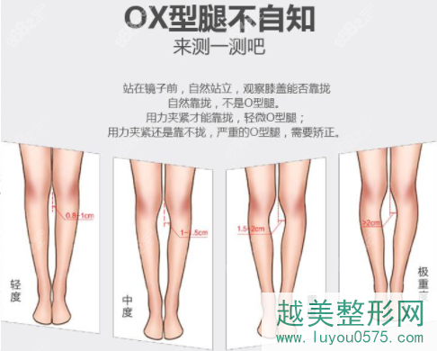 上海矫正腿型医院排名哪家好？