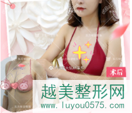 北京东方和谐隆胸案例图片参考