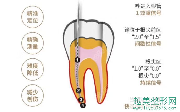 上海健皓口腔门诊部：数字化靶定点种植牙