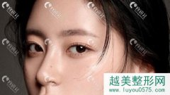 北京割双眼皮排名前十医院推荐，内附特色案例一目了然
