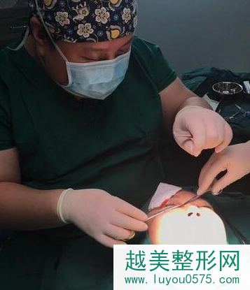 北京杨晓楠双眼皮修复案例