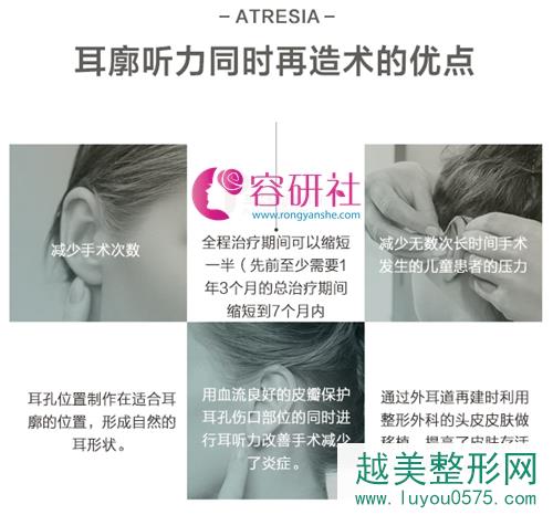 韩国profile（普露菲耳）整形外科耳整形手术优势