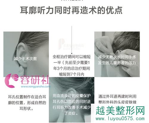 韩国普露菲耳proflie整形医院耳廓听力同时再造术的优点