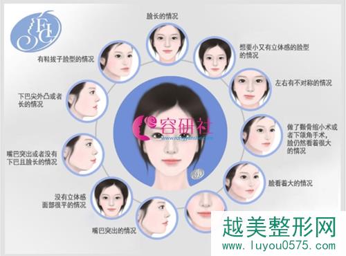 韩国菲斯莱茵FACELINE整形外科 脸型分类