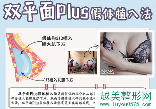韩国NANA整形医院双平面plus隆胸对产后胸部下垂果好吗？价格是多少？