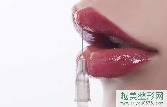 上海玻尿酸丰唇价格