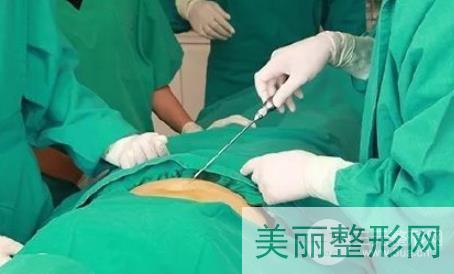 北京同仁医院吸脂手术价格