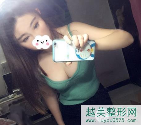 上海第九人民医院脂肪隆胸案例