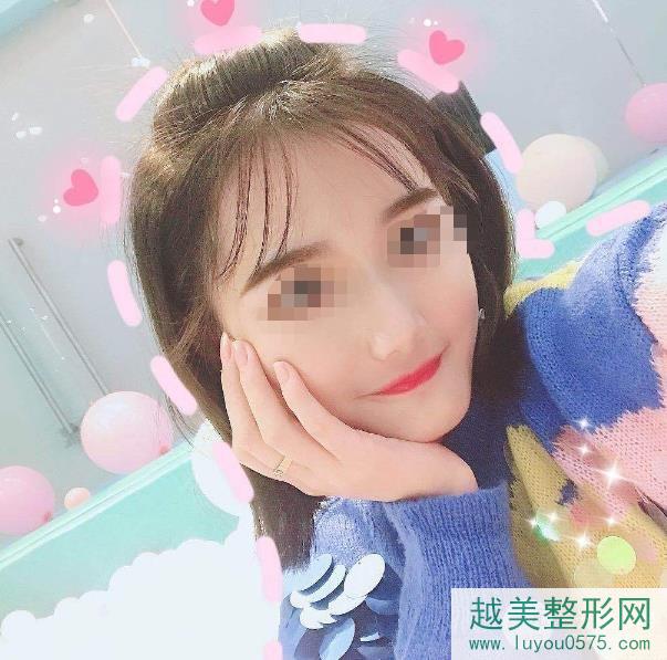 上海第九人民医院整形科改脸型案例术后