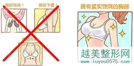 女性胸部下垂的几种情况