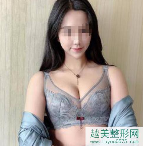 深圳北大医院整形科隆胸案例术后照