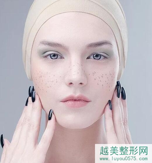 上海九院激光美容价目表，案例：蜂巢激光美肤祛斑1cm?
