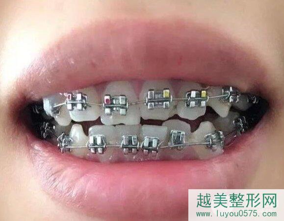 淮北中医院口腔科怎么样？让牙齿变的更加整齐漂亮！