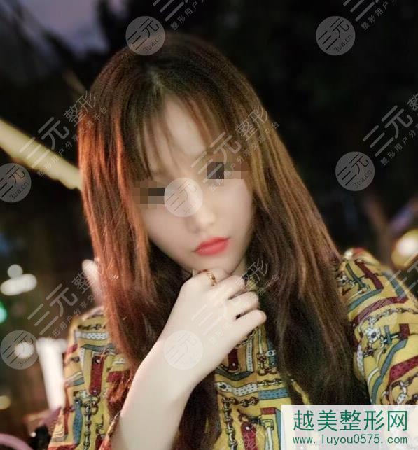 上海第九整形美容医院鼻部手术案例