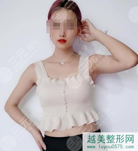 武汉中南医院整形科腰腹吸脂案例