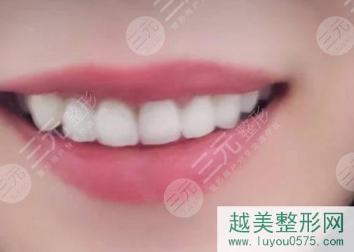 郴州第一人民医院口腔科李芬芳种植牙图片