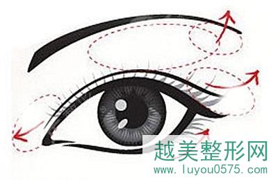 北京双眼皮修复比较好的医生