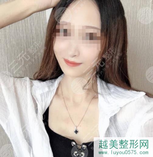 上海九院美容科注射瘦脸案例