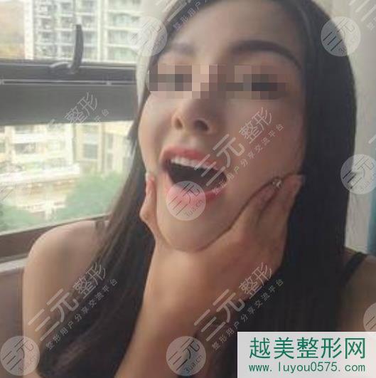 北京维尔口腔医院种植牙反馈图