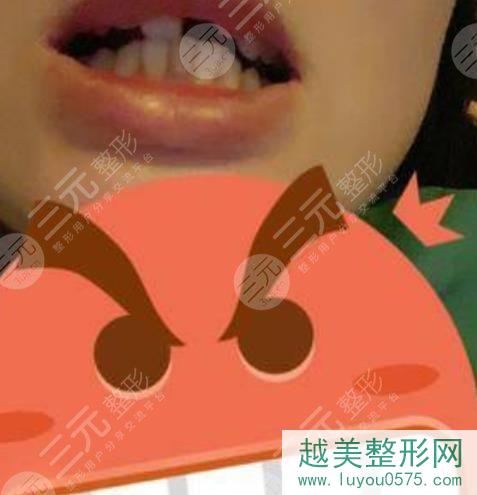北京维尔口腔医院种植牙怎么样？