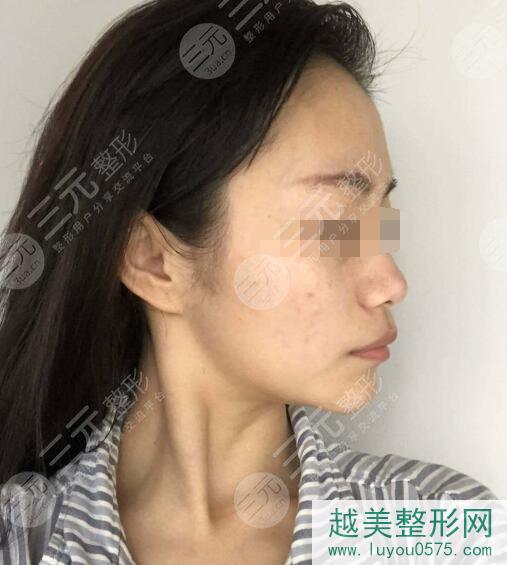 上海九医院激光美容科激光祛斑前