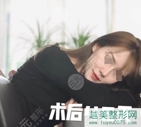 上海九院整形科鼻头缩小案例后45天