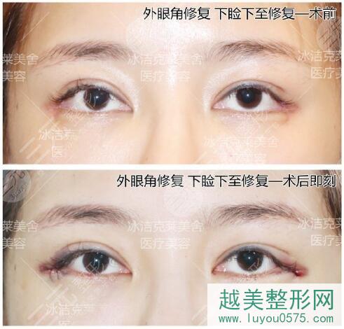 中国很难预约的十大双眼皮修复专家