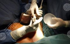 中国很难预约十大隆胸专家的清单 隆胸专家有哪些？